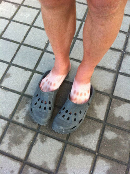 Crocs